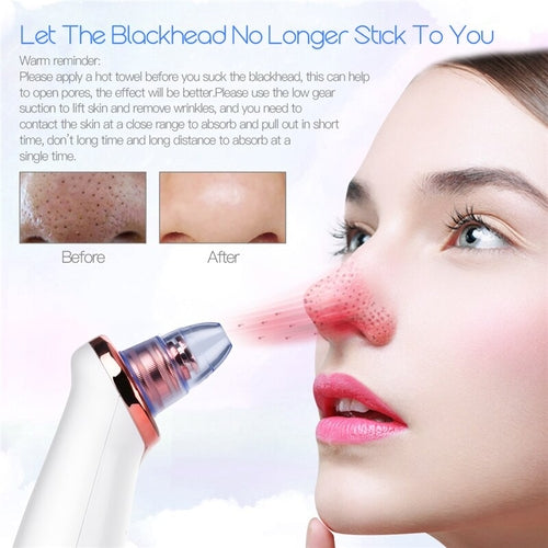 The Deep Extraction Pore Vacuum