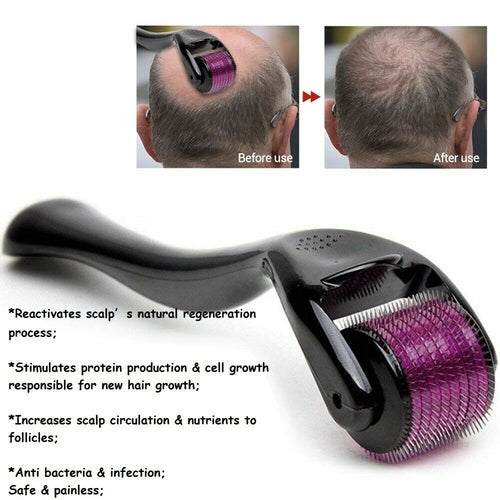 The Precision Micro-Needle Stimulator