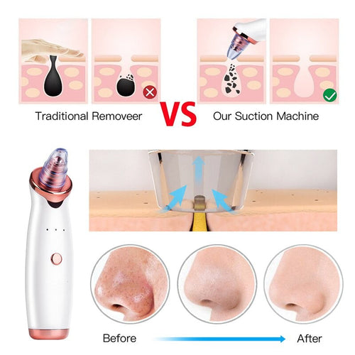 The Deep Extraction Pore Vacuum