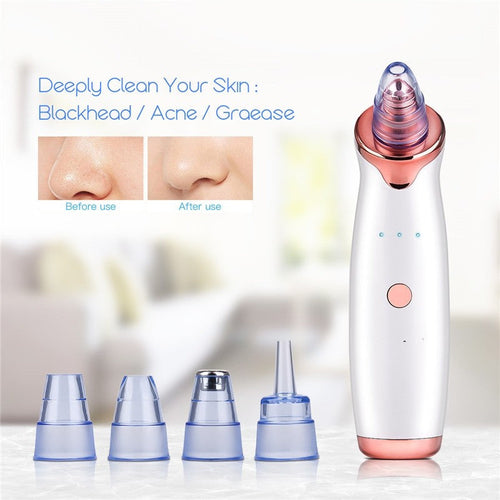 The Deep Extraction Pore Vacuum